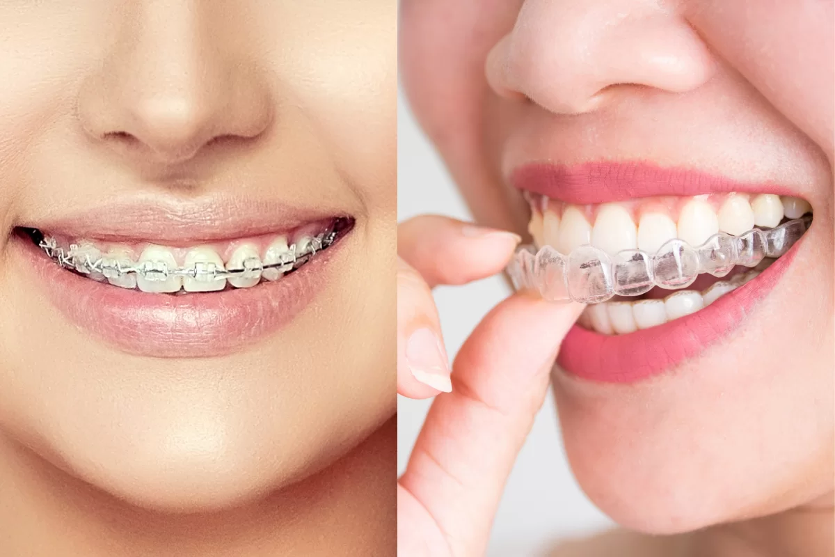 Adult orthodontist Hawthorn for Modern Orthodontic Solutions